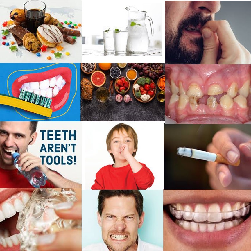 12 Things That Can Harm Your Teeth - Dental Implant Center